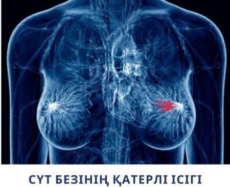Сүт безінің қатерлі ісігі - сүт безі тінінен дамитын ісік.